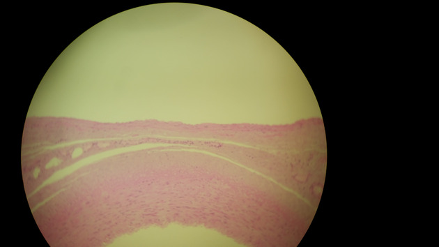 Artery and Vein Slides - Artery and Vein 001 100X